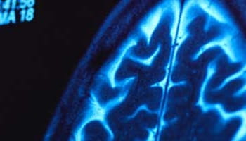 Alzheimer's Unmet Needs